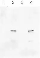 photographie montrant deux bandes noires en vis à vis sur fond gris clair