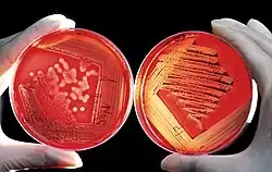 Une boîte utilisée pour la culture de bactéries sur un gel d'agar-agar.