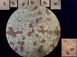 Spores de Bolbitie jaune-d'œuf.