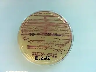 Culture d'Escherichia coli sur CPS E à partir d'une urine.