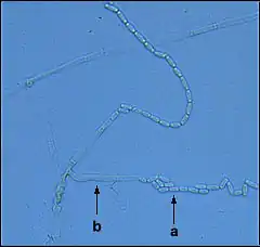 Endoconidie de Ceratocystis fagacearum