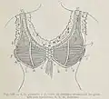 Corselet-gorge de Mme Cadolle.