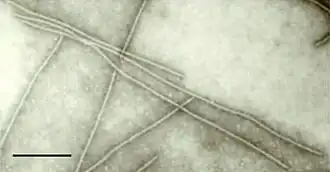 Description de l'image Cowpea mmv micrograph.jpg.