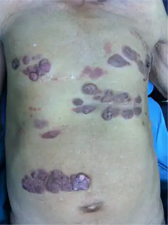 Description de cette image, également commentée ci-après