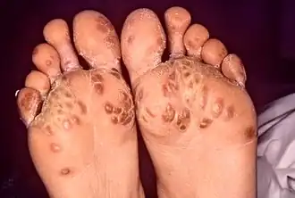 Description de cette image, également commentée ci-après