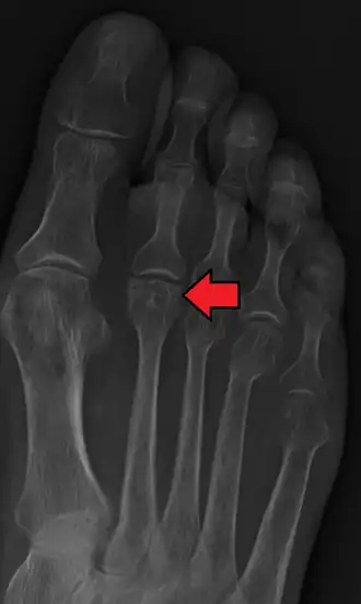 Description de cette image, également commentée ci-après