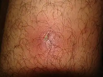 Description de cette image, également commentée ci-après