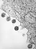 Herpèsvirus humain type 6 après libération de la membrane cellulaire.