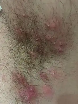 Description de cette image, également commentée ci-après