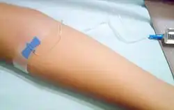 Image illustrative de l’article Ublituximab