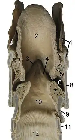 Larynx de cheval : coupe coronale.