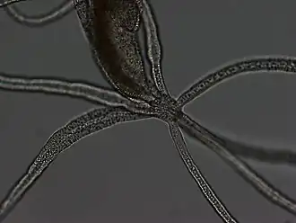 Halammohydrida octopodides (Actinulida)