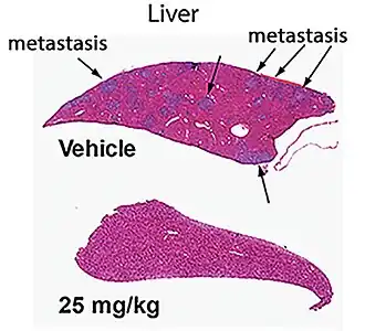 Description de l'image Liver Cancer in Mouse Model (42507312762).jpg.