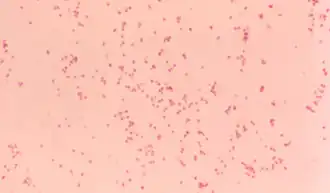 Description de l'image Moraxella Catarrhalis.png.