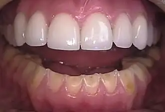 Description de cette image, également commentée ci-après