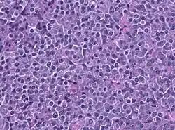 Description de l'image PRL HE histology.jpg.