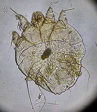 Sarcoptes scabiei.