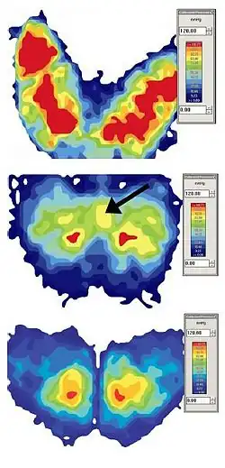 Pression de la position assise