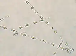 Skeletonema costatumN-O Mer Noire.