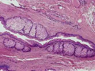 Description de l'image SkinTumors-P6260388.JPG.