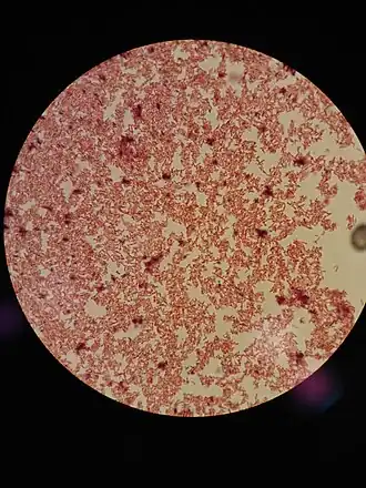 Description de l'image The Gram Staining - Bacteria Gram Negative.JPG.