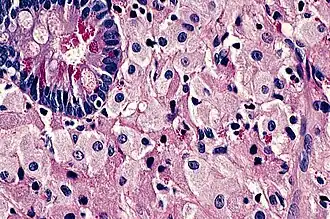 Description de cette image, également commentée ci-après