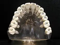 Notation ISO pour les dents de la mâchoire supérieure