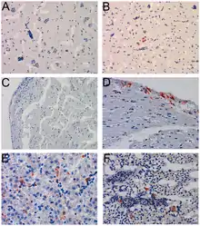 Histologie de tissus de merle not, non infectés (A, C) et infectés (B, D, E et F) par le virus Utusu, aussi appelé USUV.