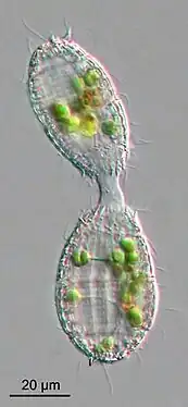 Conjugaison de deux Coleps sp. Les partenaires d'apparence similaire mais sexuellement distincts connectés par leurs extrémités, s'échangent du matériel génétique via un pont de plasma.