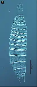 Echinoderes hwiizaa, un Kinorhyncha.