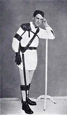 Photographie en noir et blanc d'un homme debout muni d'un appareillage orthopédique complexe, prenant la jambe droite.