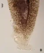 Partie postérieure du corps, noter asymétrie.