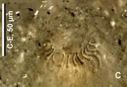 Épines de l'appareil copulateur mâle.