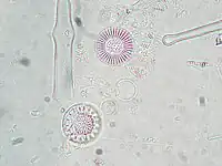 Stephanodiscus alpinus.