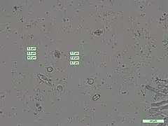  Photographie au microscope de petites sphères mesurées dans leur longueur et leur largeur