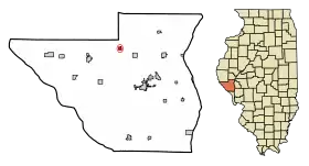 Localisation de Baylis